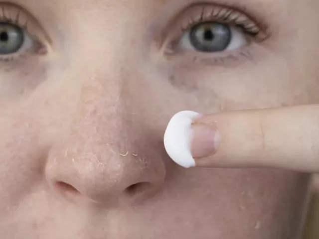 how to get rid of dry skin apply lotion