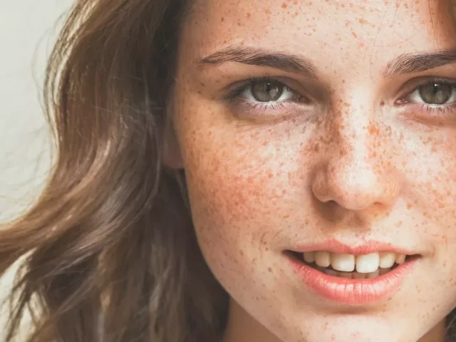 Woman smiling with a face of freckles, not wearing makeup