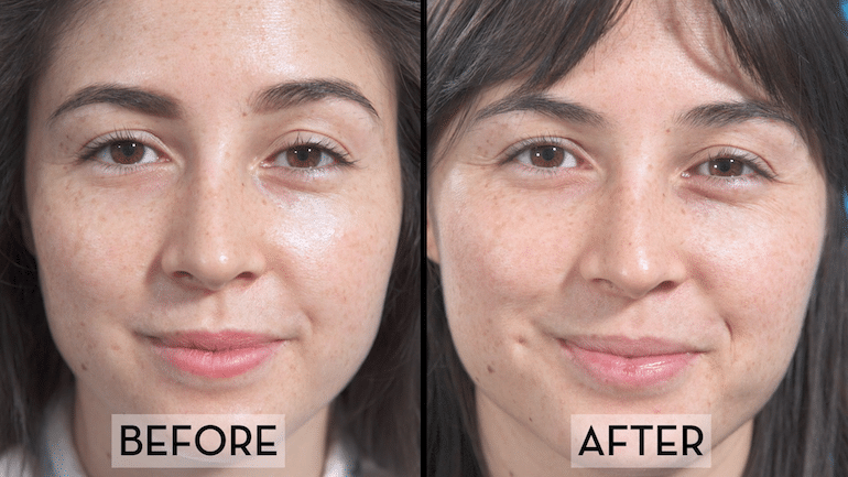 Skin Fasting Before & After