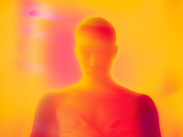 toasted skin syndrome